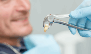 after tooth extraction