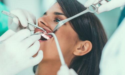 Do You Really Need a Dental Checkup Every 3 Months?