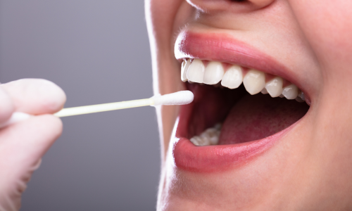 Saliva in maintaining oral health