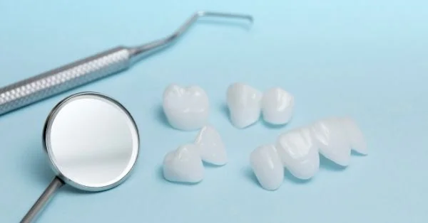 braces vs veneers