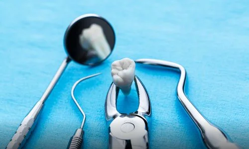 Sedation Dentistry in Bend - A Whole New Experience