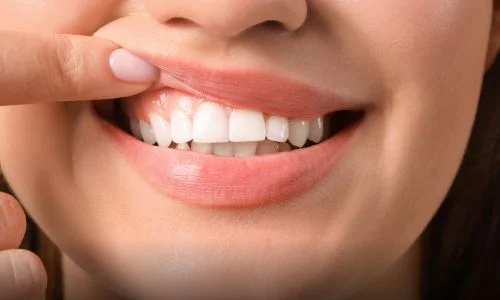 Do You Have Healthy Teeth? How to Figure it Out!