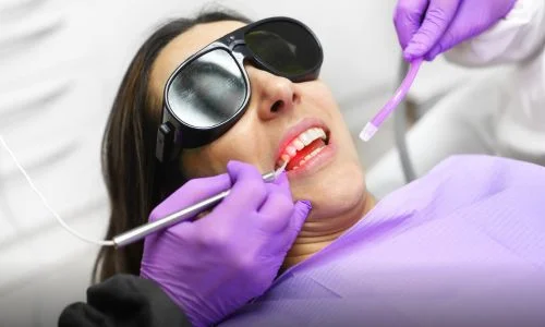 Is Laser Teeth Whitening Worth It?