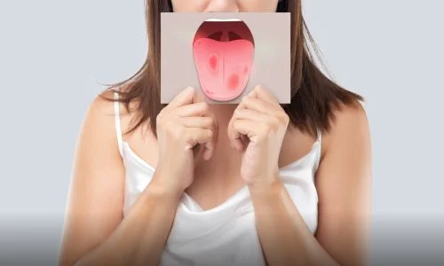 Oral Microbiome