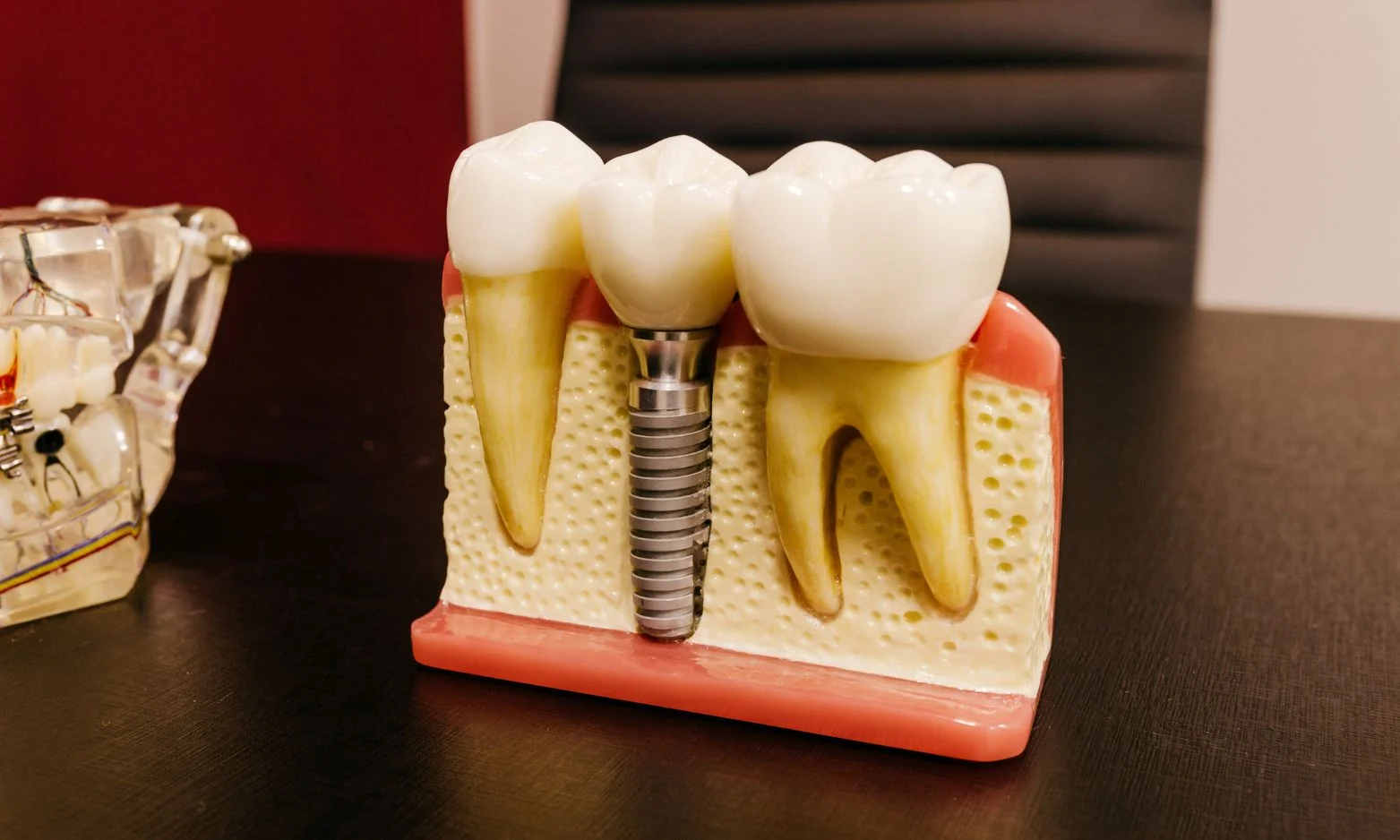 dental implants pain