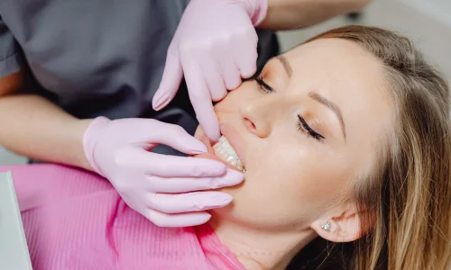sensitive teeth whitening