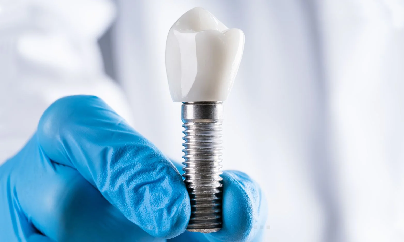 dental implant vs bridge