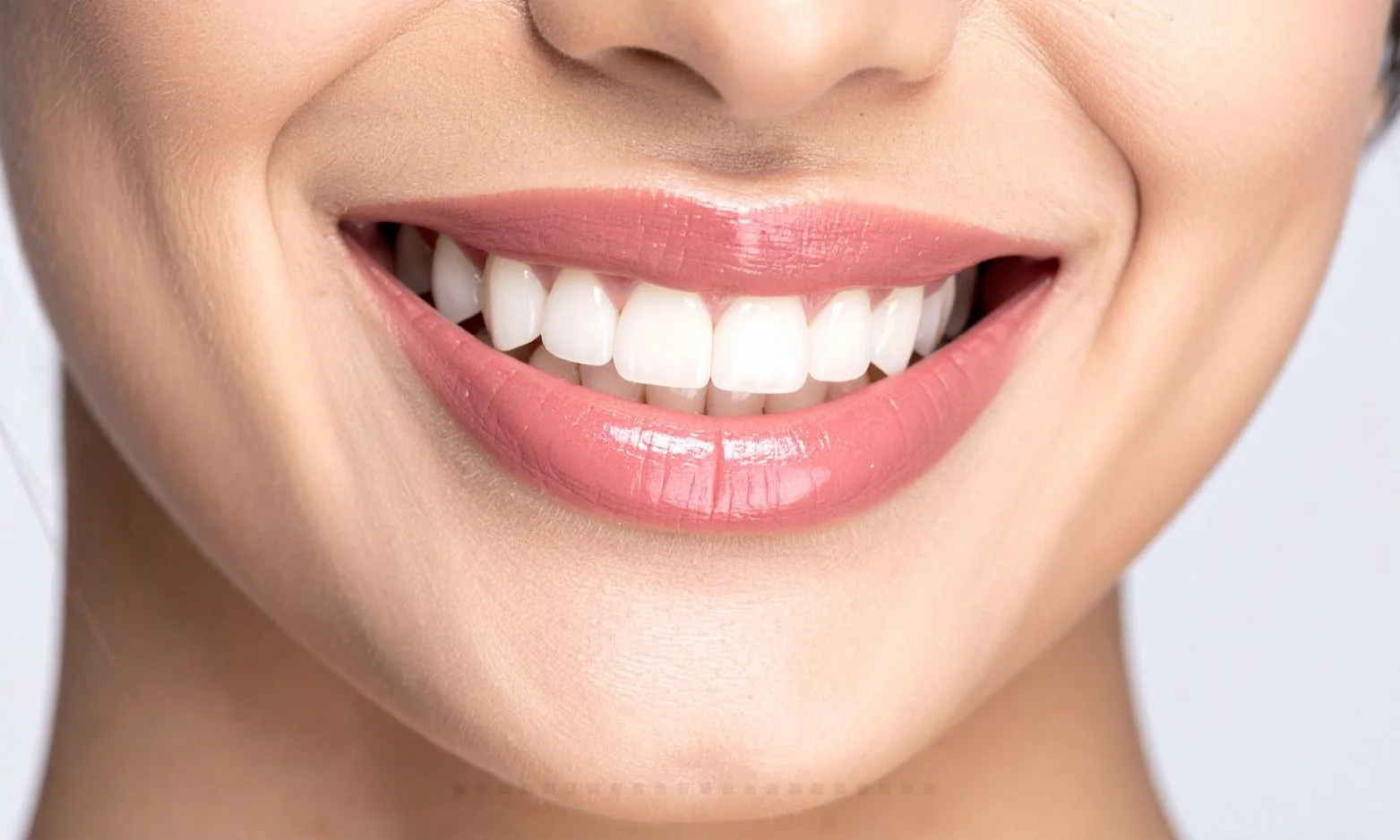 teeth whitening