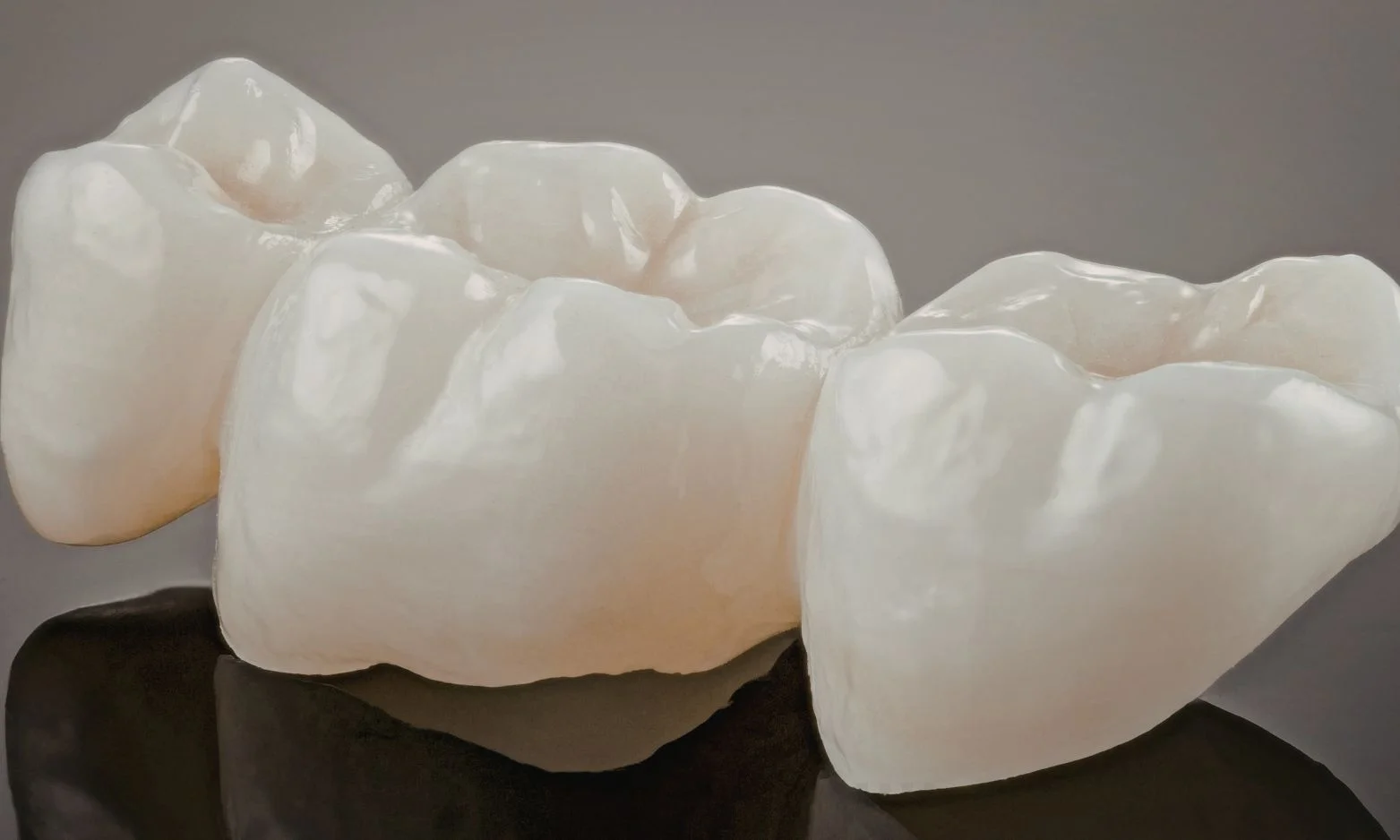 Dental crowns