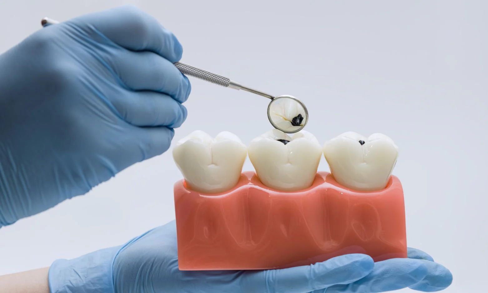 cavities